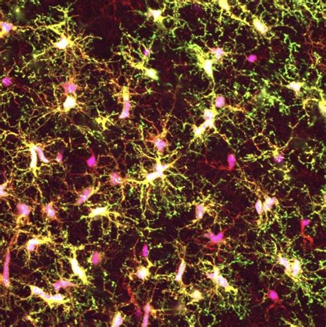 Whitehead Institute team develops new method to study human brain cells - MIT Department of Biology