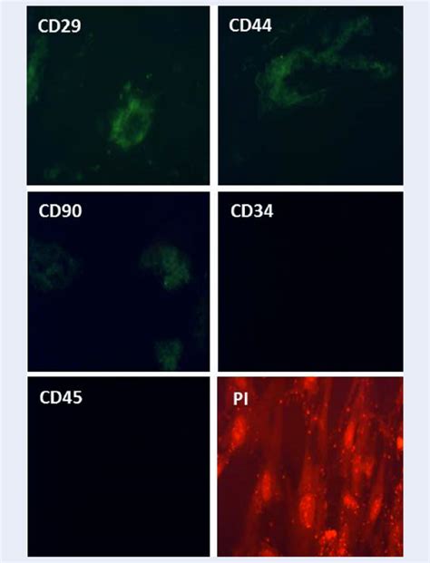 Immunocytochemistry analysis of cell surface markers in SMSCs. Cells... | Download Scientific ...