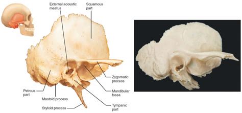 Temporal bone anatomy, parts of temporal bone & temporal bone fracture