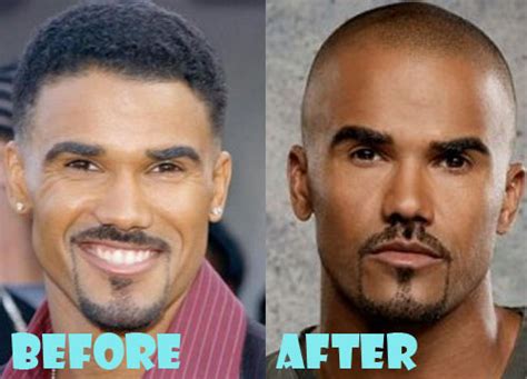 Shemar Moore Pl astic Surgery Nose Job - Lovely Surgery | Celebrity Before and After Picturer