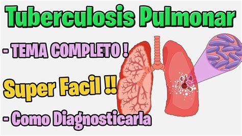 TUBERCULOSIS PULMONAR | SINTOMAS, FISIOPATOLOGIA, TRATAMIENTO - YouTube