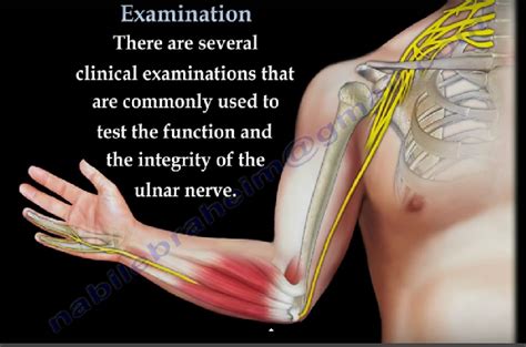 Ulnar Nerve-Clinical Examination — OrthopaedicPrinciples.com