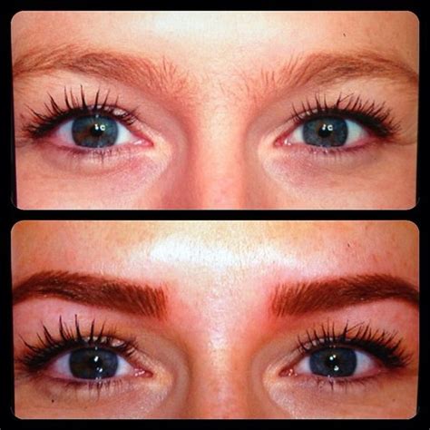 Laser Eyebrow Tattoo Removal Before and After | TATTOOS EYEBROW ...