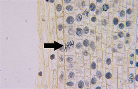 Metaphase Under A Microscope