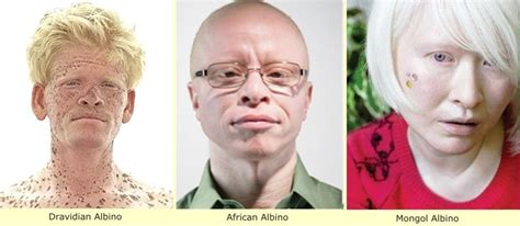 Phenotype makes Race? Do Tell! | Albino, You are so beautiful to me, Aboriginal people