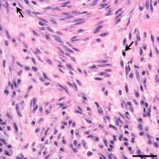 Dog; primary soft tissue sarcoma, left lumbar fascia. The neoplastic... | Download Scientific ...