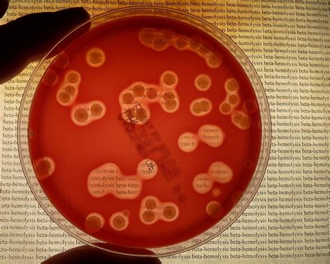 Difference Between Alpha and Beta Hemolysis | Compare the Difference ...