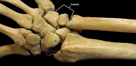 Types of Synovial Joints | Biology for Majors II