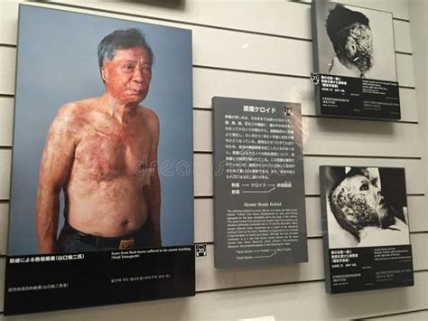 Nagasaki Atomic Bomb Museum is a Remembrance To the Atomic Bombing of Nagasaki Displays ...