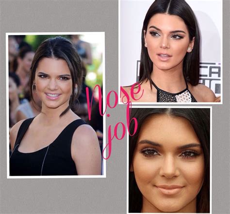 Kendall Jenner nose job | Kendall jenner nose job, Nose job, Celebrity look alike