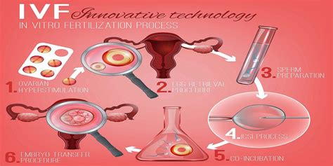 IVF Procedure Step By Step | IVF Process Start to Finish