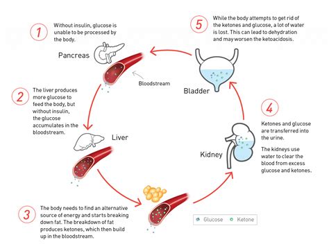 Diabetic Ketoacidosis (DKA) – Why should it matter to me? | Nipro