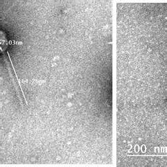 Transmission electron microscope (TEM) image of phage showing its... | Download Scientific Diagram