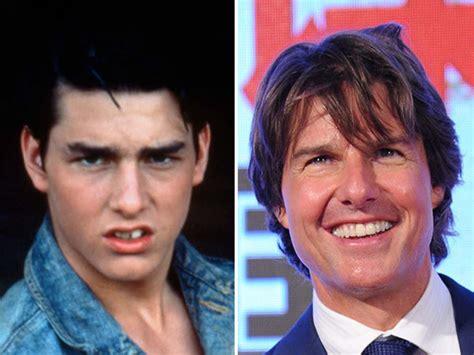 Tom Cruise's Teeth Before And After: When Did The Actor Fix His Teeth?