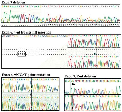 Representative sequence traces of exon 6 and 7 frameshift or point... | Download Scientific Diagram