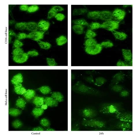 The apoptotic cell photos were taken by fluorescence microscope after... | Download Scientific ...