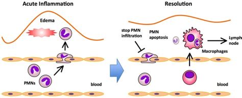 Major processes in acute inflammation and resolution. The initiation... | Download Scientific ...