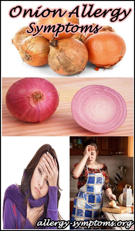 Onion Allergy Symptoms and Diagnosis - Allergy-symptoms.org