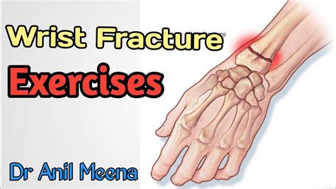 wrist fracture recovery exercises | wrist fracture physiotherapy ...