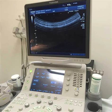 Scapulothoracic bursitis – cortisone injection - Arthritic Chick