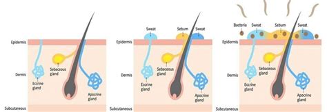 Can Sebum Hair Loss Be Reversed | Skalptec Ltd