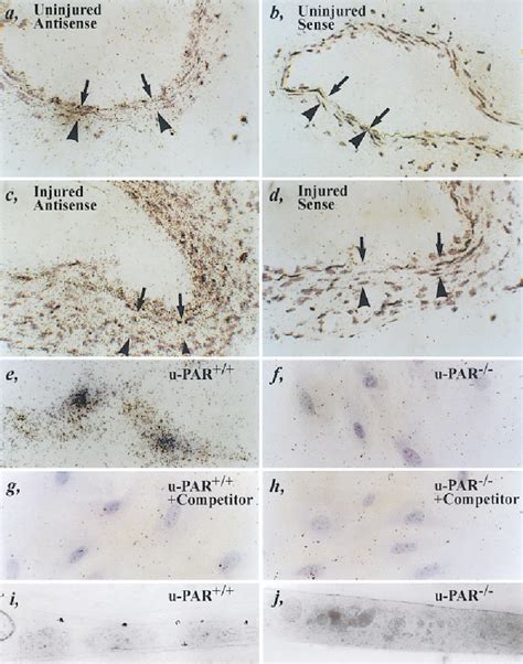 Figure 5 from Receptor-independent Role of Urokinase-Type Plasminogen Activator in Pericellular ...