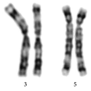 Cell-line #1: karyotype: 46, XY, der (3) t (3; 5) (p26; p15.3).ish. (a)... | Download Scientific ...