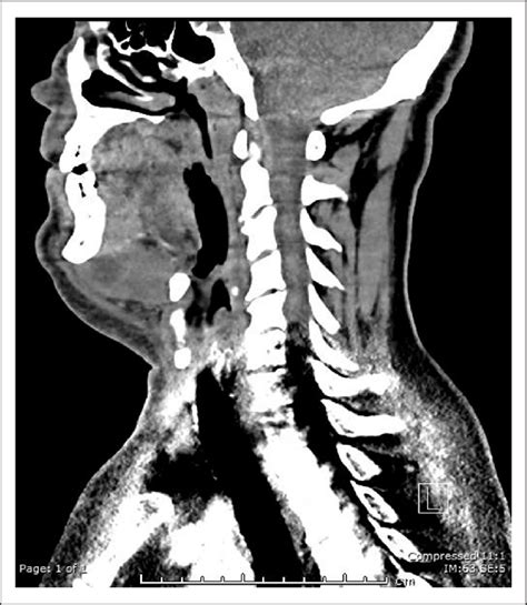 computed tomography with contrast reformatted in parasagittal plane... | Download Scientific Diagram