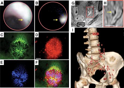 Molecular Imaging in Cancer | Science