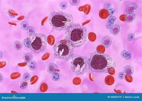 Chronic Lymphocytic Leukemia CLL Cells Cluster in Blood Flow ...