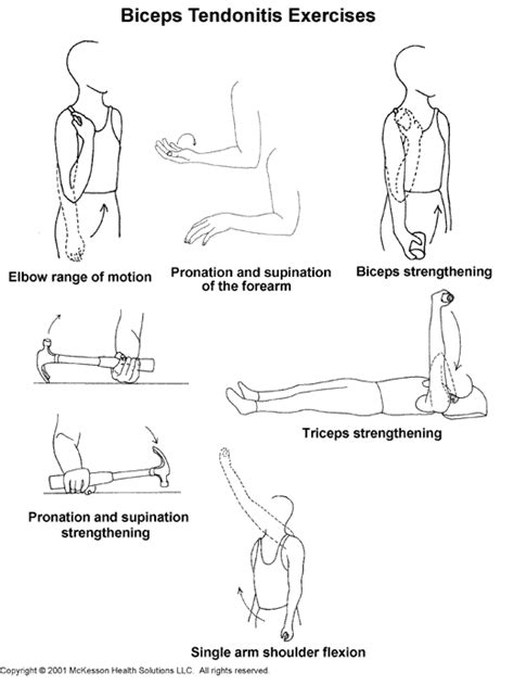 Sports Medicine Advisor 2003.1: Biceps Tendonitis Exercises: Illustration