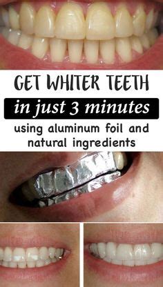 How To Whiten Teeth With Coconut Oil And Baking Soda - Teeth Poster