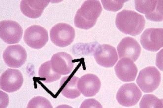 hypogranular platelet atlas : Biological Science Picture Directory ...