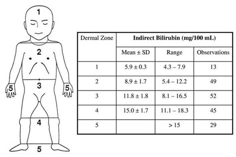 Newborn Jaundice 101 (Complete Guide For Parents) | Ethissa