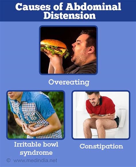 Abdominal Distension - Causes, Symptoms, Diagnosis, Treatment