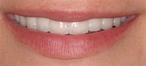 Best Cosmetic Dentist Near Me - Dental News Network