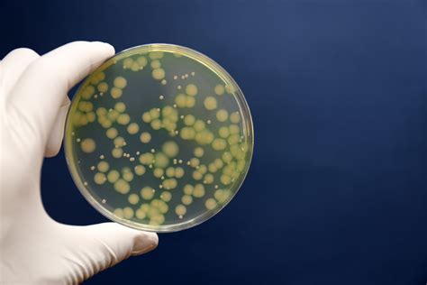 細菌の鑑別 緑膿菌 Pseudomonas aeruginosa | Aerobiology Laboratory Associates