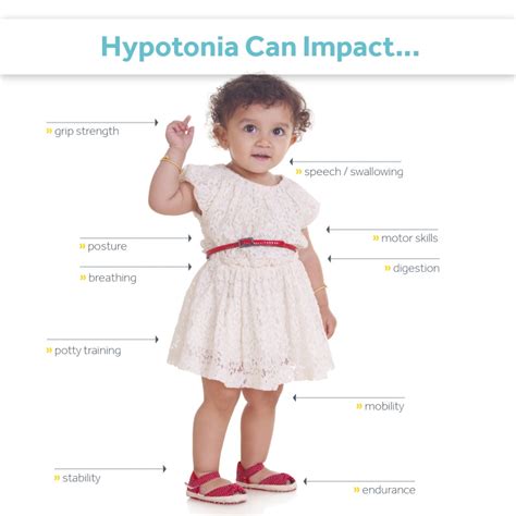 What is Hypotonia? – Milestone Pediatric Therapy