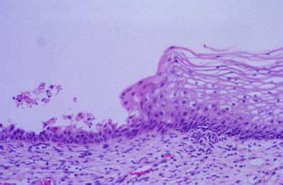 Uterus Histology - Cervix - histology slide