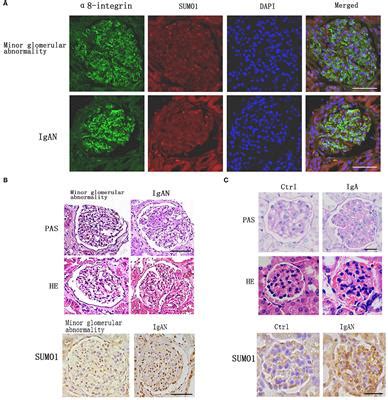 Frontiers | SUMO1 Promotes Mesangial Cell Proliferation Through Inhibiting Autophagy in a Cell ...