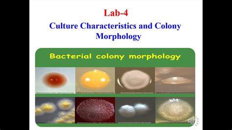 Clip mariposa extraño Brillar colony morphology Eliminar Adoración Gaseoso