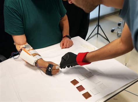 Researchers develop a prosthetic arm that provides the sense of heat ...