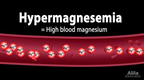 Hypermagnesemia: Causes, Pathophysiology, Symptoms, Diagnosis and ...