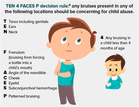 Be Wary of the Bruise: Don’t Forget the Full-Body Exam EMRA