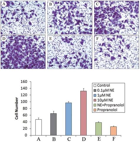 Cell invasion assay in pancreatic cancer cell line Miapaca-2. NE (1 and... | Download Scientific ...