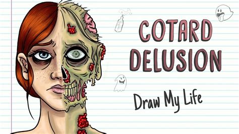 Cotard's Delusion (Walking Corpse Syndrome) | Delusional, Syndrome, Rare disease