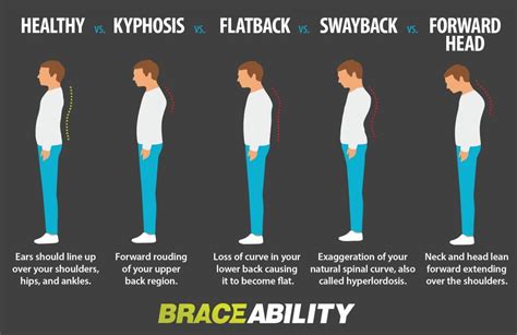 Pin on Posture Improvement | Braces, Yoga and Exercises to Correct Bad Posture