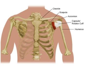 Shoulder Pain and Problems | Stanford Health Care