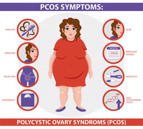 MENGENAL PCOS (SHARING PEJUANG GARIS DUA) ~ Komunitas Permata Hati