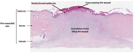 Wound Healing Studies Now Available in Europe | Charles River